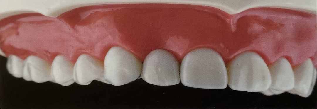 neue Zähne after 1080